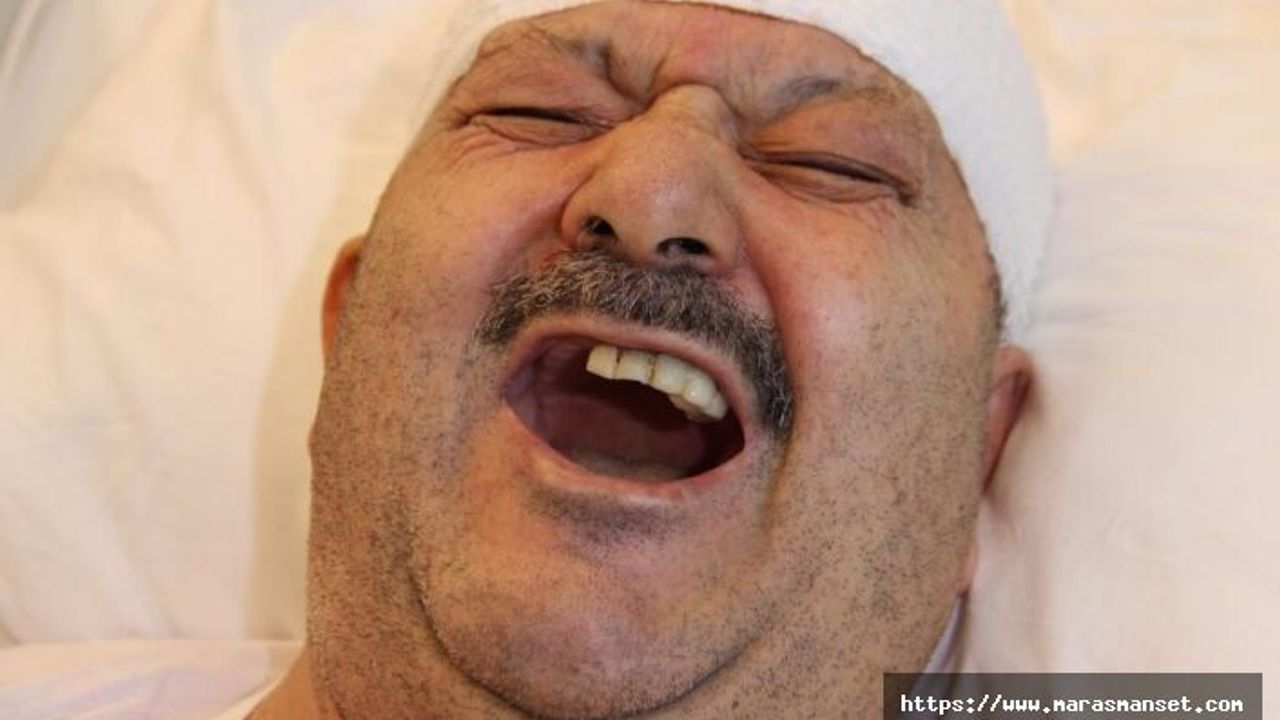 Diş ağrısı sanıp 6 sağlam dişini çektirdi, meğer gerçek bambaşka çıktı