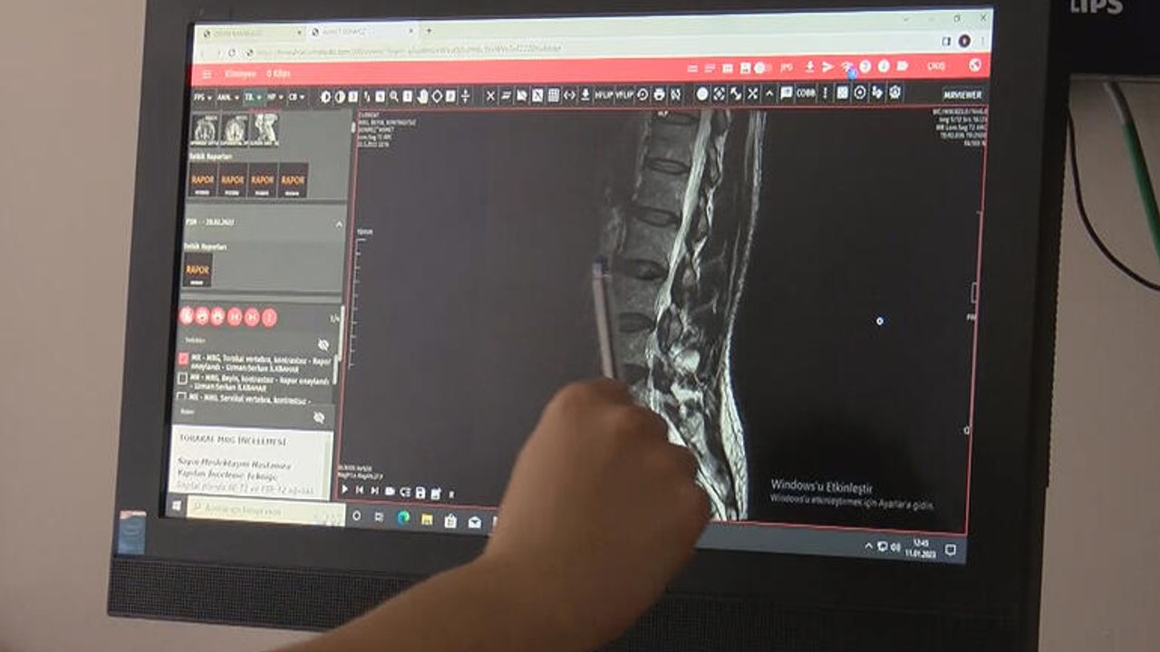 Dünyada ilk, Türk hekimler ispatladı: Tiroid hastalıkları omurga hasarına yol açıyor