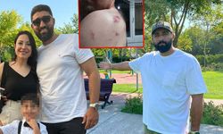 İki aile arasında 'çocuk' kavgası; 1'i çocuk, 3 yaralı