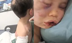 Dehşeti yaşayan 2 yaşındaki bebek hastanelik oldu