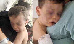 Bebeği hastanelik eden caniler gözaltına alındı