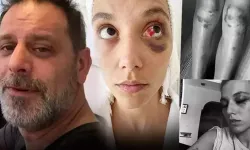 Ozan Güven'e 'kasten yaralama' suçundan 1 yıl 15 ay hapis cezası