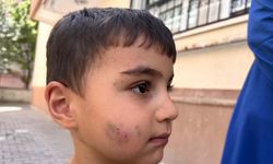 Evde uyuyan çocuğu lağım faresi ısırdı