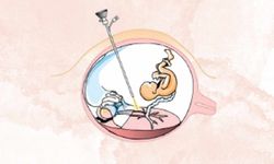 Anne karnında ameliyat hayat kurtarıyor