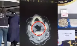 Midesinden yarım kilo metamfetamin çıktı