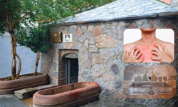 Kahramanmaraş’taki Uyuz Pınarı hangi hastalıklara iyi geliyor?