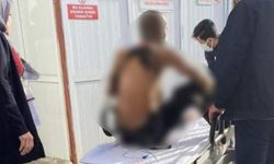 Afşin Belediyesi’nden Kendini Yakma Olayına İlişkin Açıklama