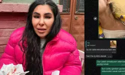 İlişkisini bitirmek istedi darbedilip burnu kırıldı: Yaşamak istiyorum