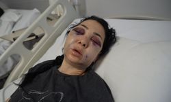 Oğlunun gözü önünde anneyi öldüresiye dövdüler