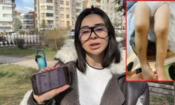 Kreşte 2 yaşındaki çocuğun darbedildiği iddiasıyla suç duyurusu