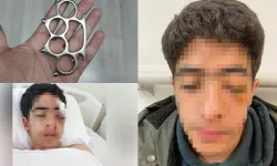 Akran zorbalığına bir yenisi eklendi: 15 yaşındaki çocuk muştayla öldüresiye dövüldü