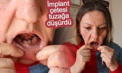 Diş ağrısı şikayetiyle gitti 25 dişinden oldu