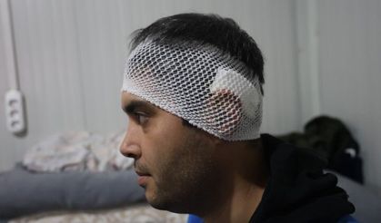 Konteyneri delip geçen yorgun mermi kafasına isabet etti!