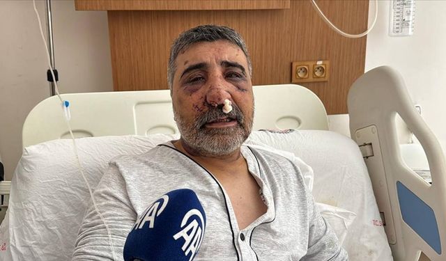İngiliz boksörün darbettiği taksici Biçer, yaşadıklarını anlattı