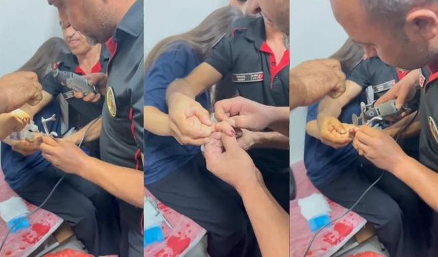 Kahramanmaraş’ta parmağına sıkışan yüzüğü itfaiye çıkardı