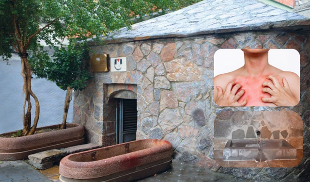 Kahramanmaraş’taki Uyuz Pınarı hangi hastalıklara iyi geliyor?