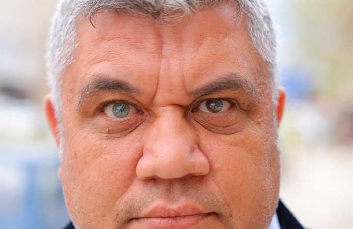 Kahramanmaraşlı adam 3 renkli gözleriyle görenlerin ilgisini çekiyor