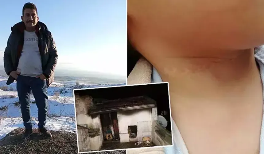 1,5 yaşındaki çocuğun boynunu kesen sanığa 21,5 yıl hapis