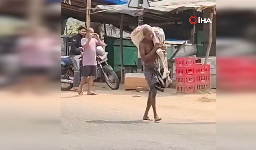 Bir adam para çekmek için kardeşinin iskeletiyle bankaya gitti