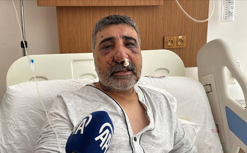 İngiliz boksörün darbettiği taksici Biçer, yaşadıklarını anlattı