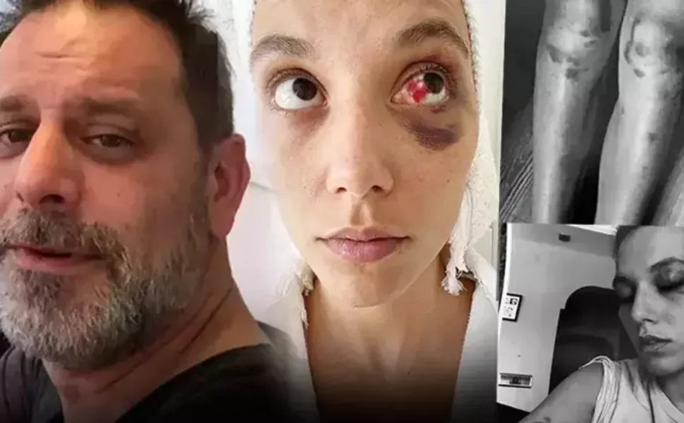 Ozan Güven'e 'kasten yaralama' suçundan 1 yıl 15 ay hapis cezası