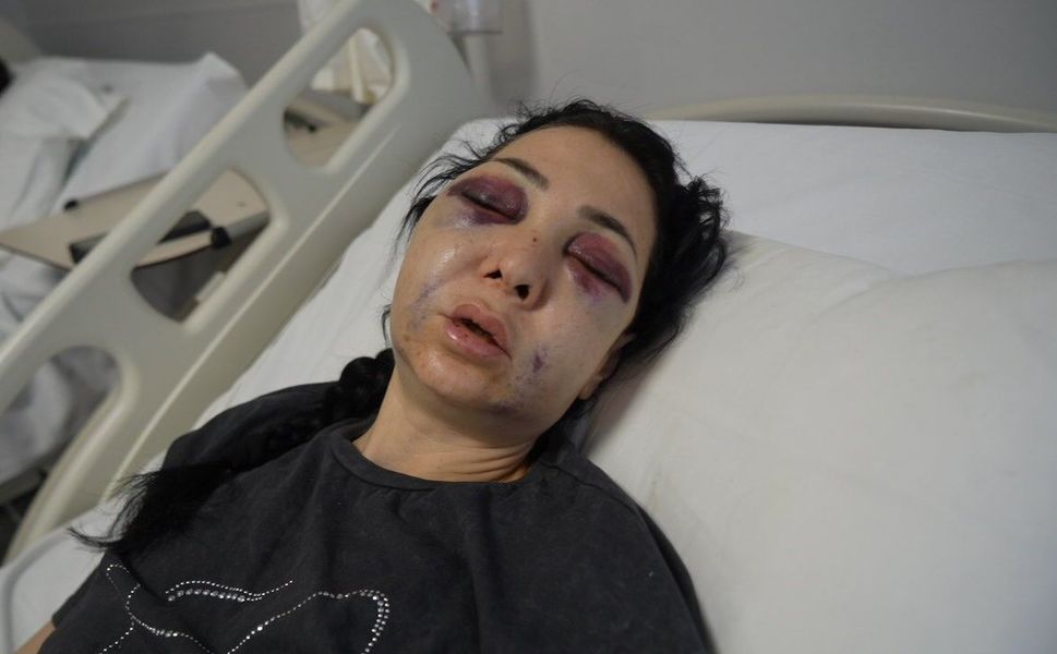 Oğlunun gözü önünde anneyi öldüresiye dövdüler