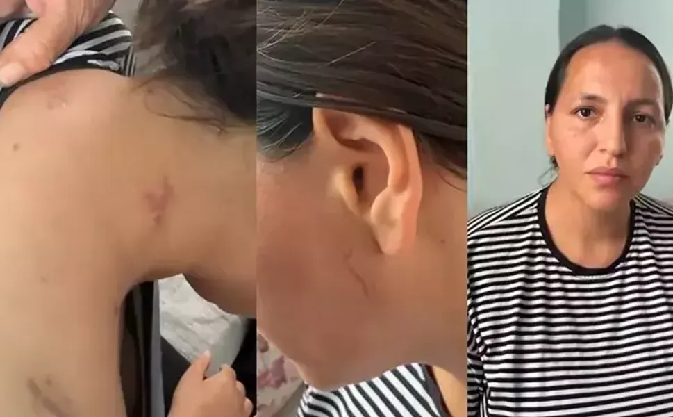 17 bıçak darbesiyle yaralanan Havva, tutuklanan eşinin en ağır cezayı almasını istedi