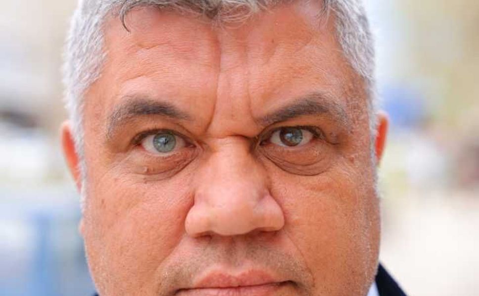 Kahramanmaraşlı adam 3 renkli gözleriyle görenlerin ilgisini çekiyor