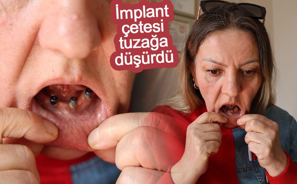 Diş ağrısı şikayetiyle gitti 25 dişinden oldu