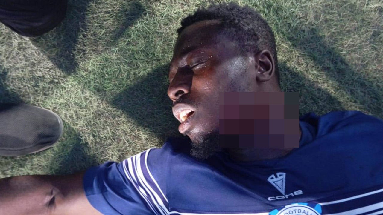 Nijeryada Dehset Taraftarlar Futbolcuyu Bogazindan Yaraladi