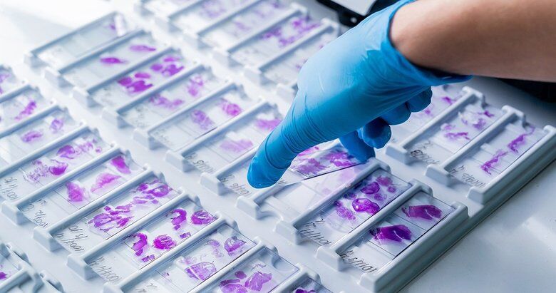 KİT KARŞILIĞI CİHAZ SATIN ALINACAKTIR